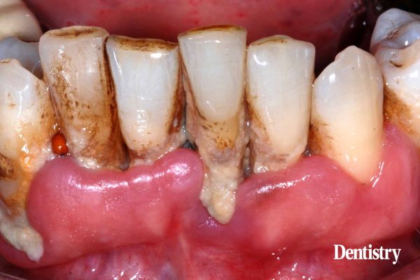 The history of oral health: a 25 year perspective