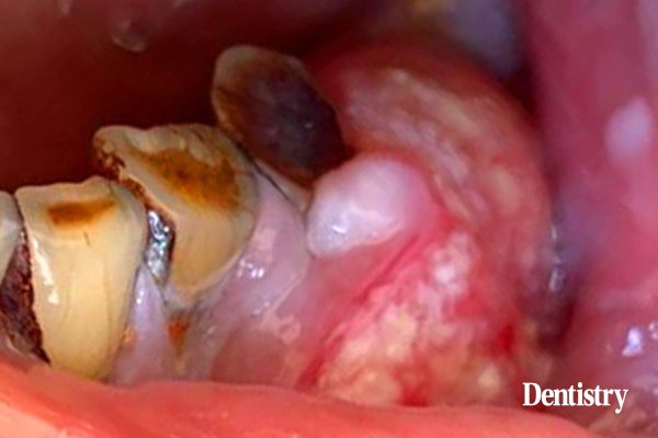 The history of oral health: a 25 year perspective