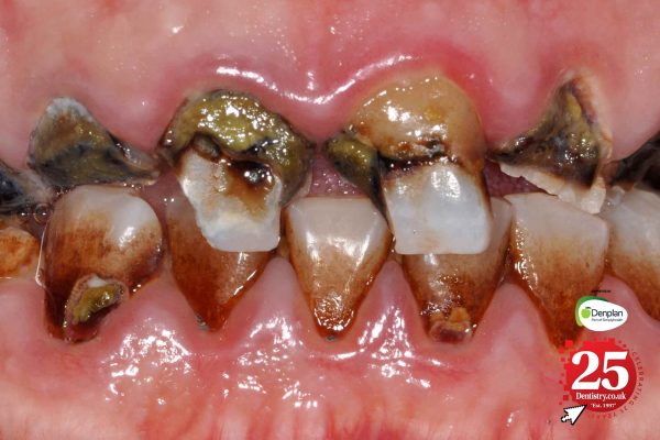 The history of oral health: a 25-year perspective
