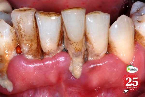 The history of oral health: a 25-year perspective