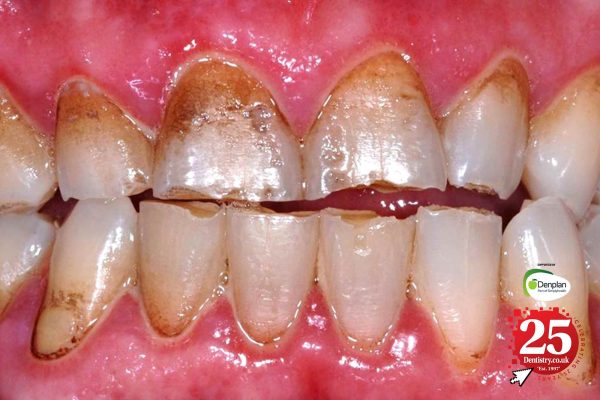 The history of oral health: a 25-year perspective