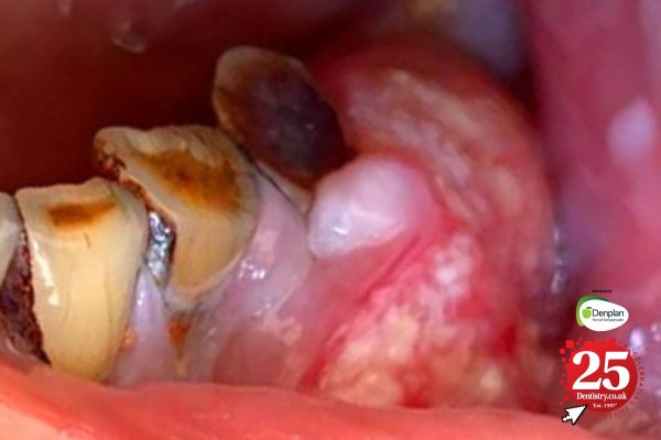 The history of oral health: a 25-year perspective