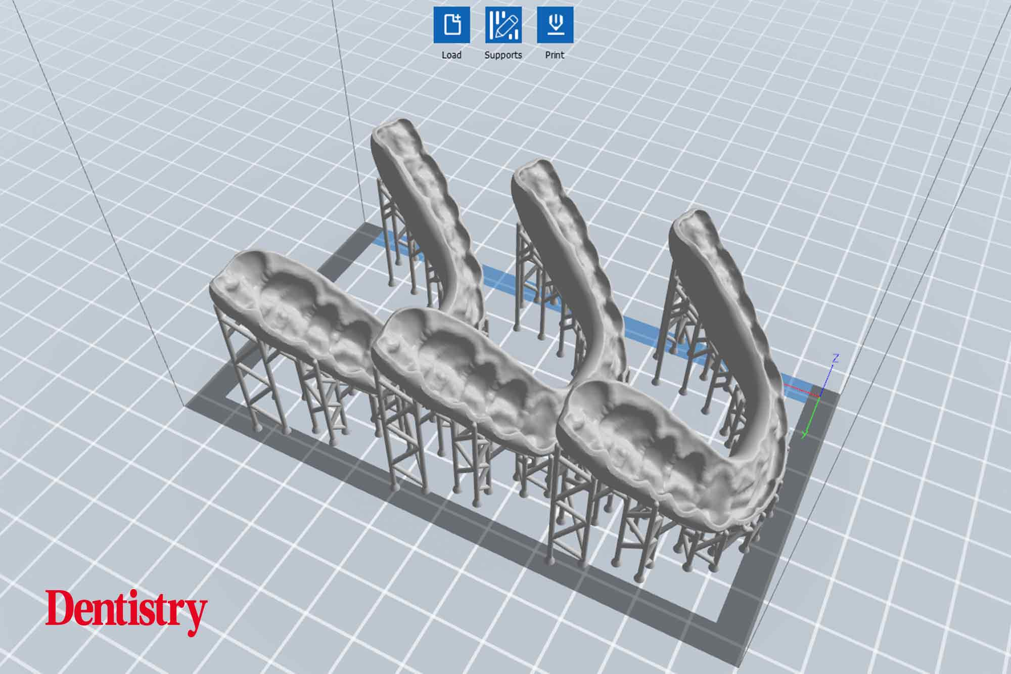 10 Andre Andre Gaul RDT gives a step-by-step overview of the design and fabrication process of printed occlusal splints.