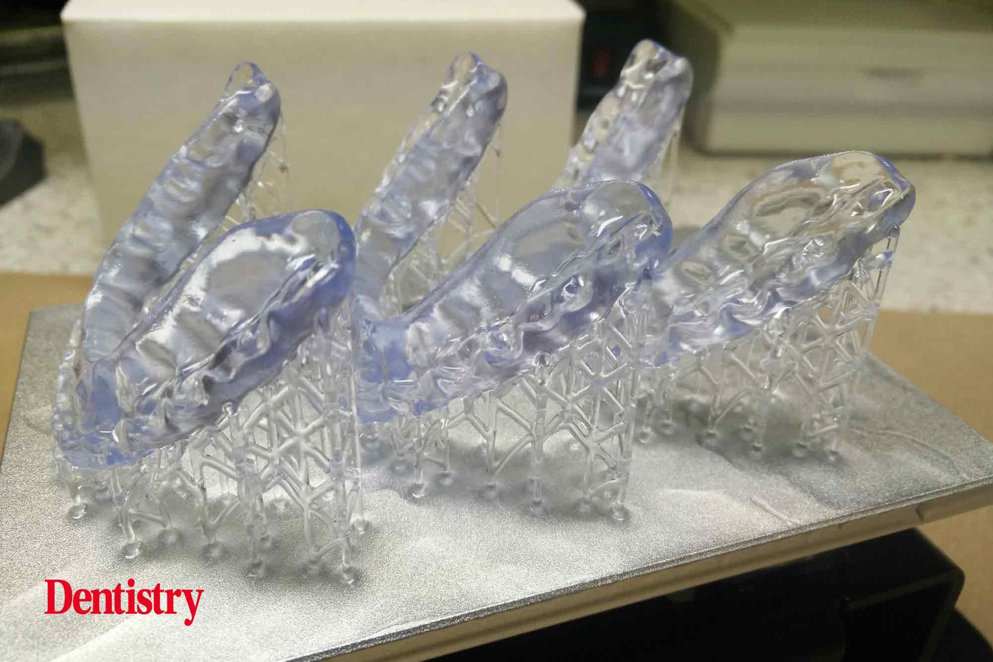 12 Andre Andre Gaul RDT gives a step-by-step overview of the design and fabrication process of printed occlusal splints.