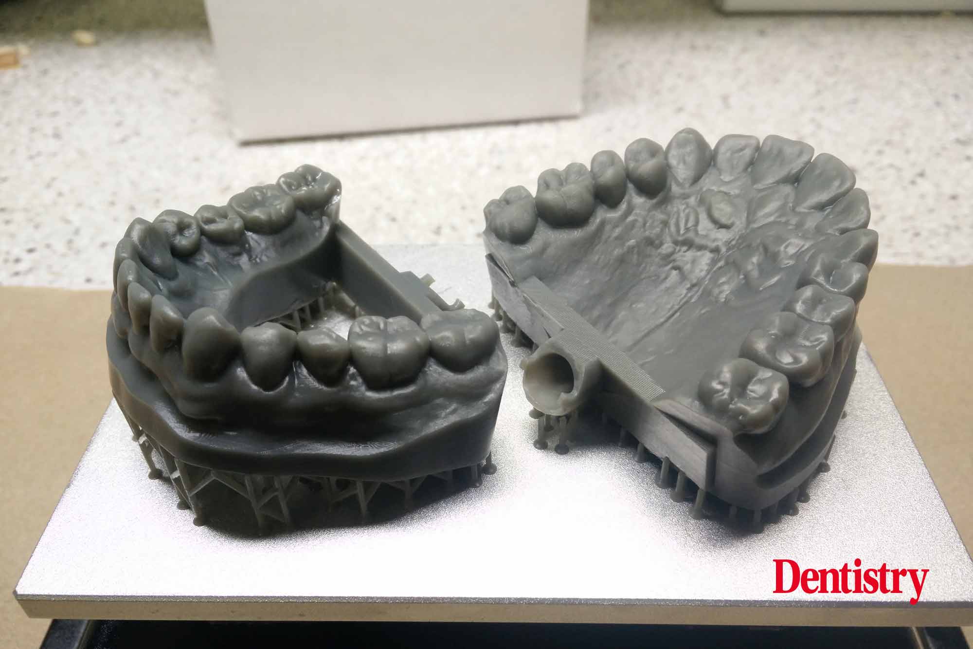 Figure 13 Andre Gaul RDT gives a step-by-step overview of the design and fabrication process of printed occlusal splints.