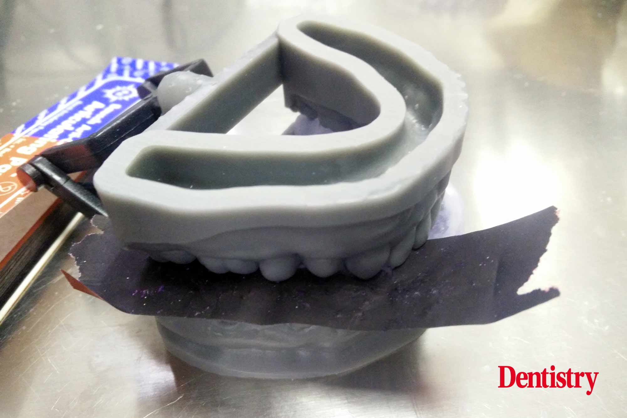 17 Andre Gaul RDT gives a step-by-step overview of the design and fabrication process of printed occlusal splints.