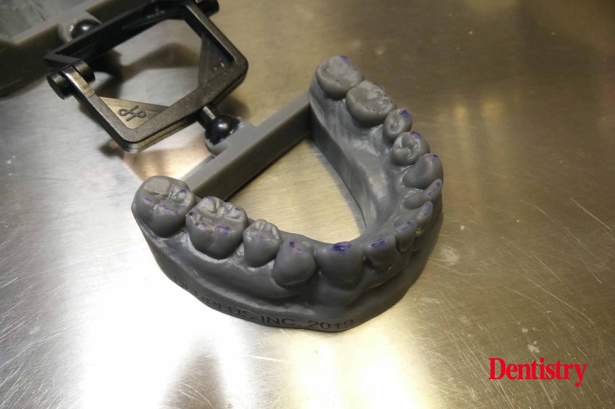 18 Andre Gaul RDT gives a step-by-step overview of the design and fabrication process of printed occlusal splints.