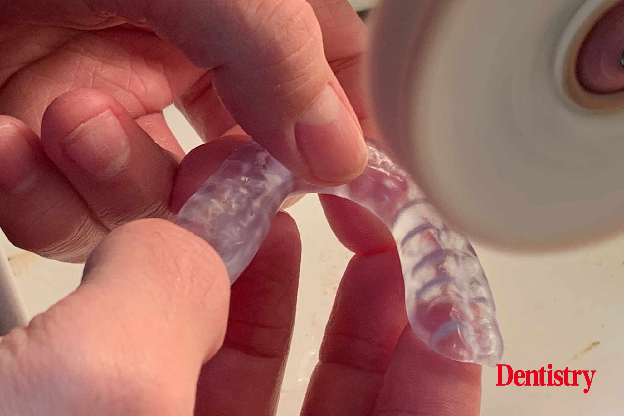 22 Andre Gaul RDT gives a step-by-step overview of the design and fabrication process of printed occlusal splints.