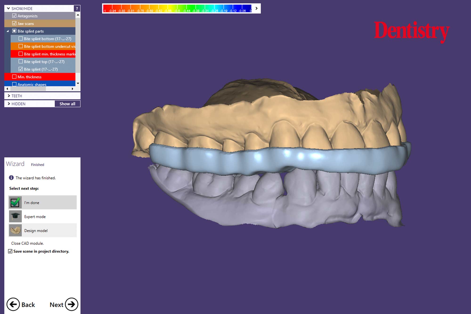 8 Andre Andre Gaul RDT gives a step-by-step overview of the design and fabrication process of printed occlusal splints.