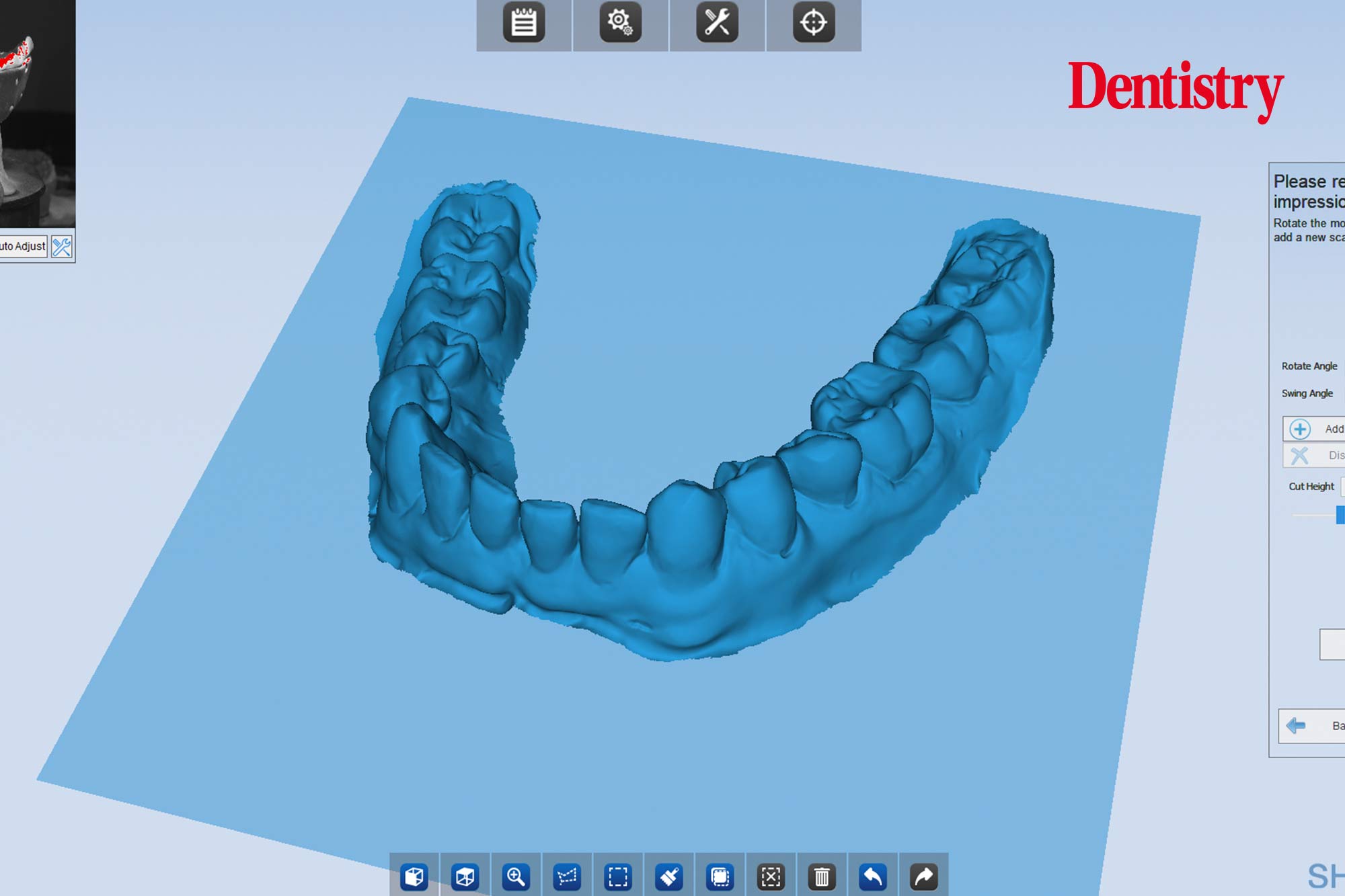 2 Andre Andre Gaul RDT gives a step-by-step overview of the design and fabrication process of printed occlusal splints.