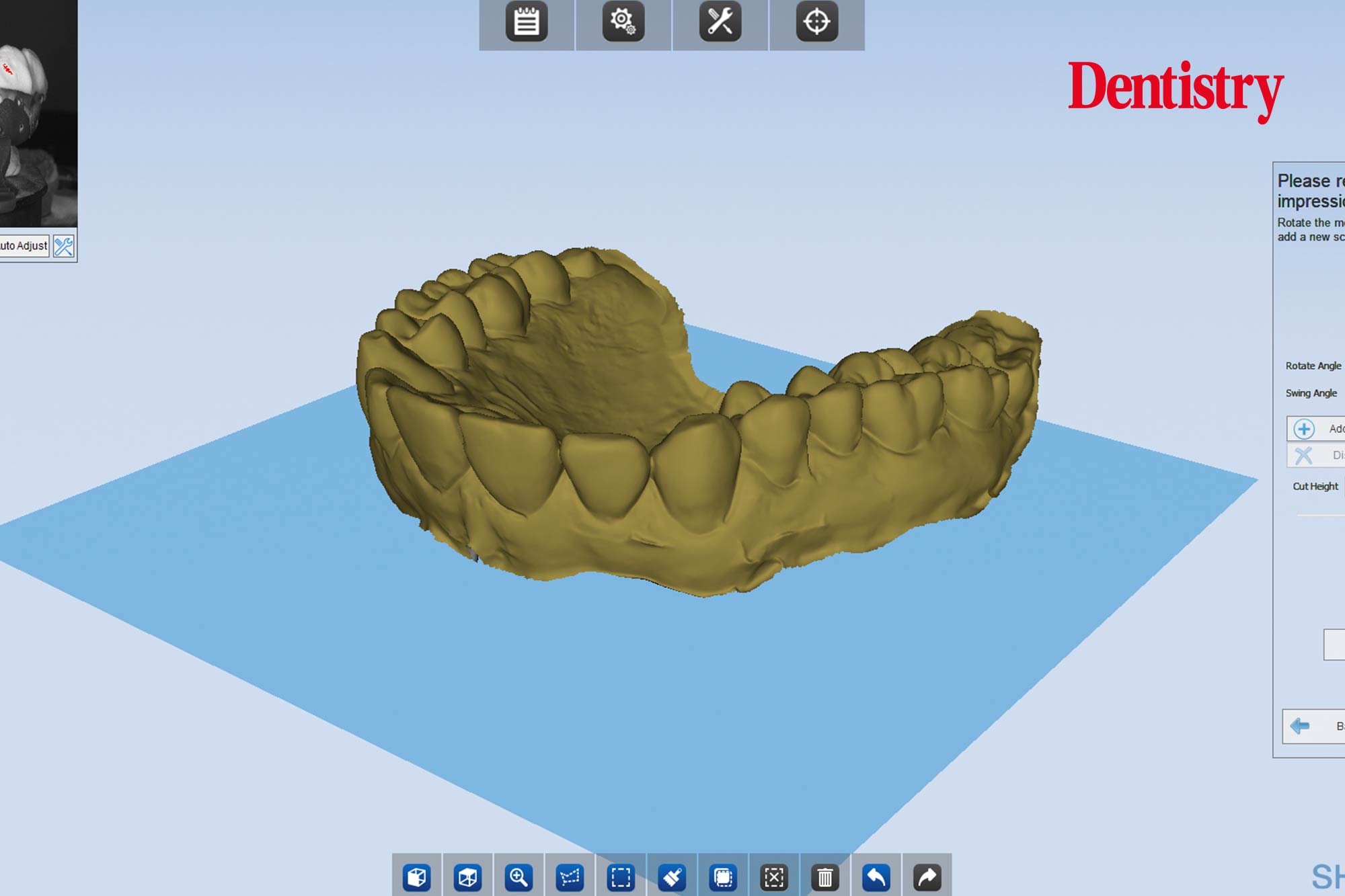 3 Andre Andre Gaul RDT gives a step-by-step overview of the design and fabrication process of printed occlusal splints.