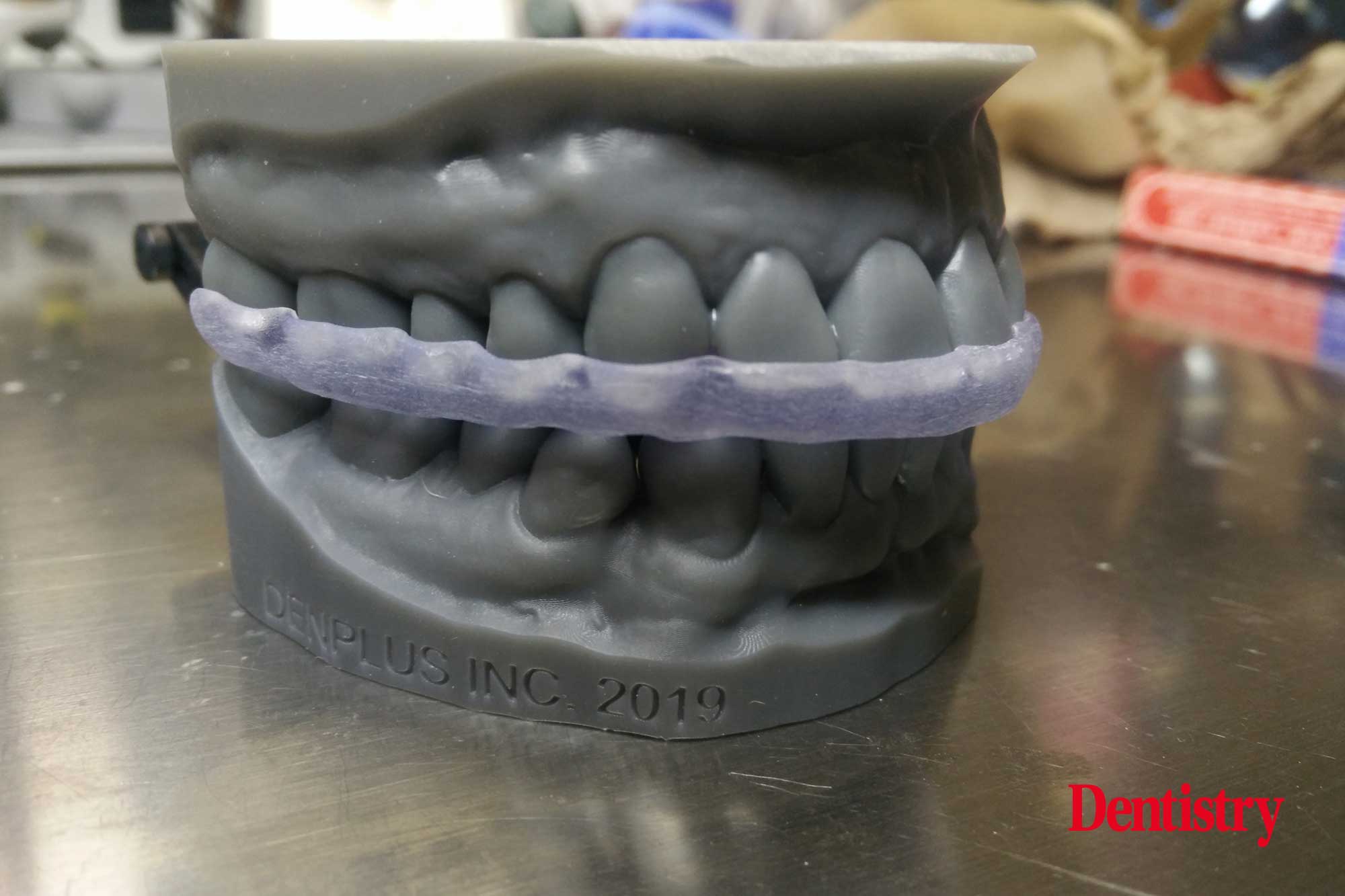 andre-20 Andre Gaul RDT gives a step-by-step overview of the design and fabrication process of printed occlusal splints.