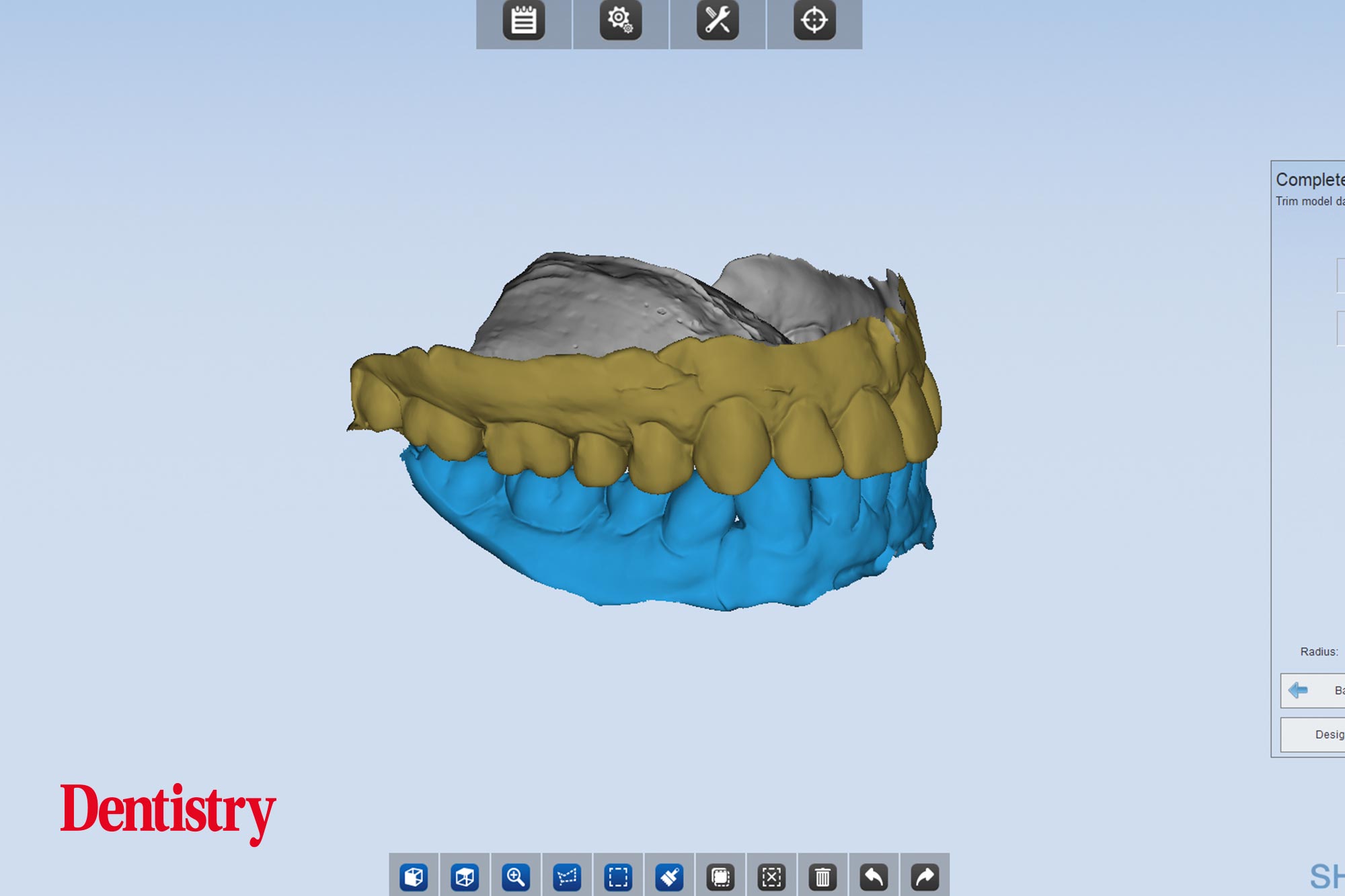 5 Andre Andre Gaul RDT gives a step-by-step overview of the design and fabrication process of printed occlusal splints.