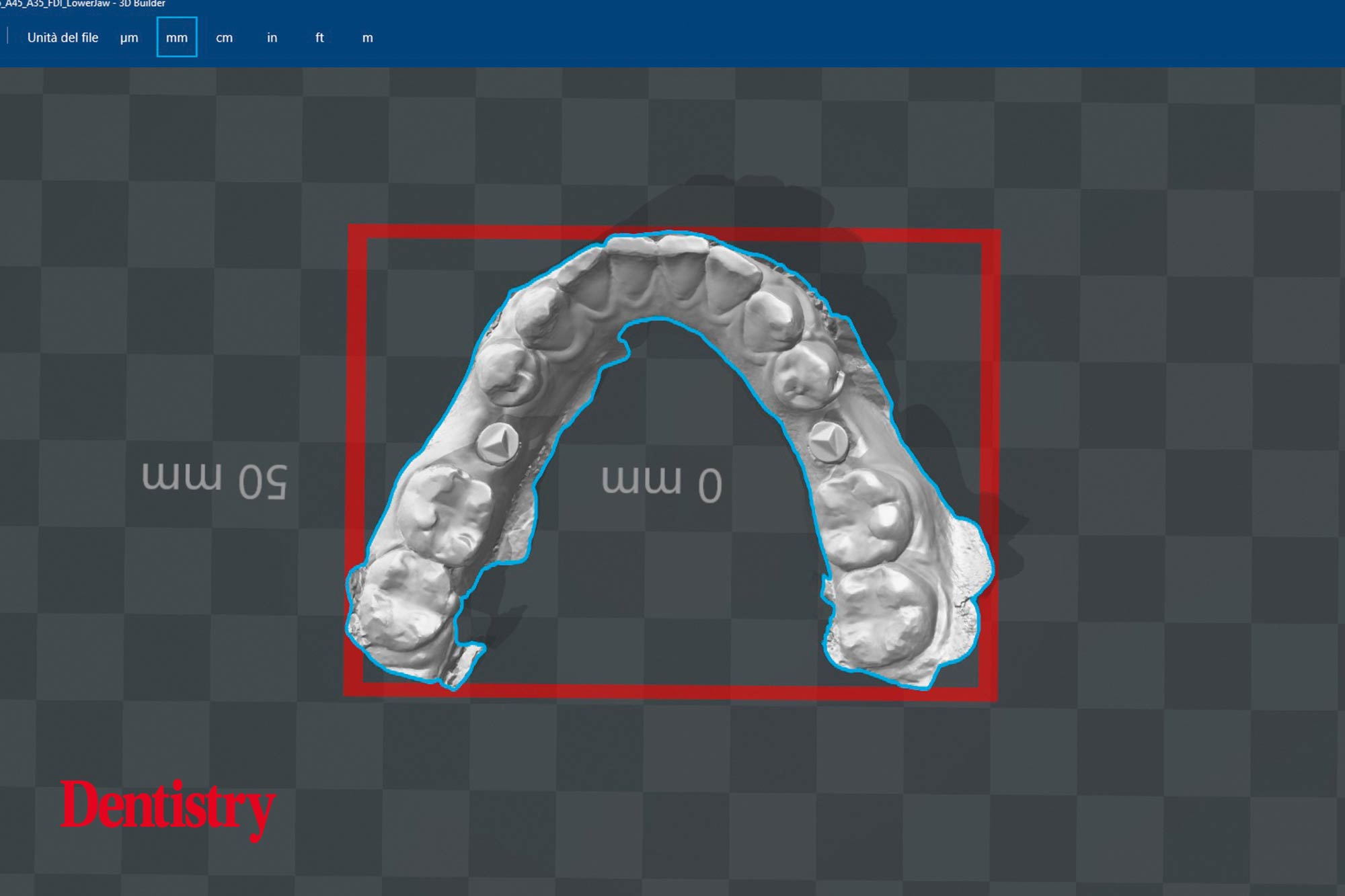 4 Mauro Fazioni and Andrea Lombardo discuss the importance of making implants with toothlike restoration materials and how you can do this.