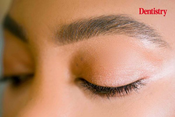 The ‘tox brow lift – what should I do?