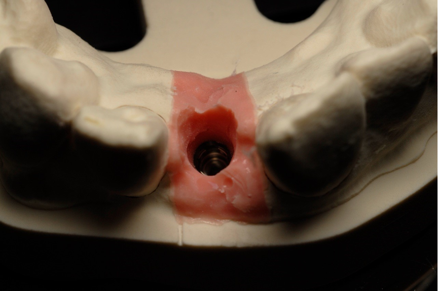 soft rubber gum
