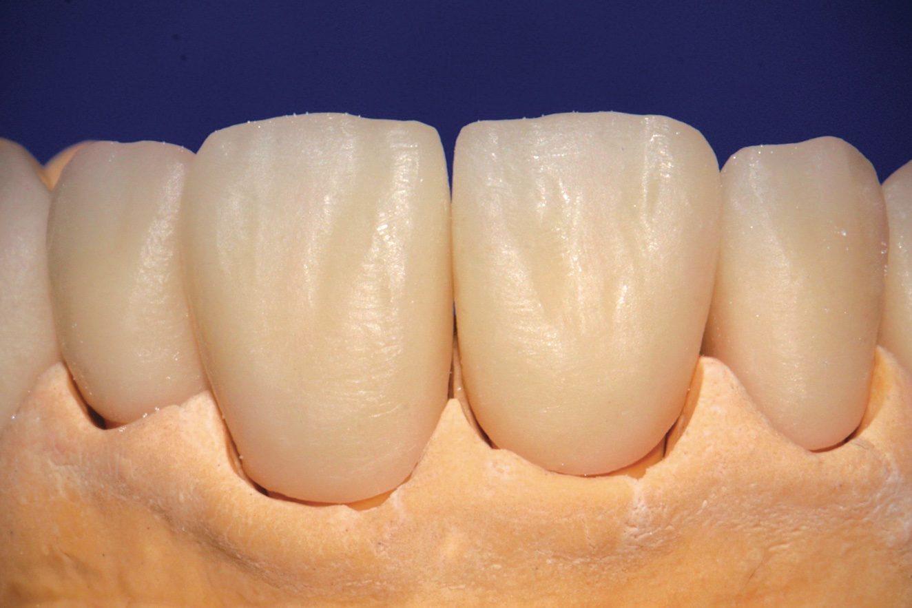 strigl 27