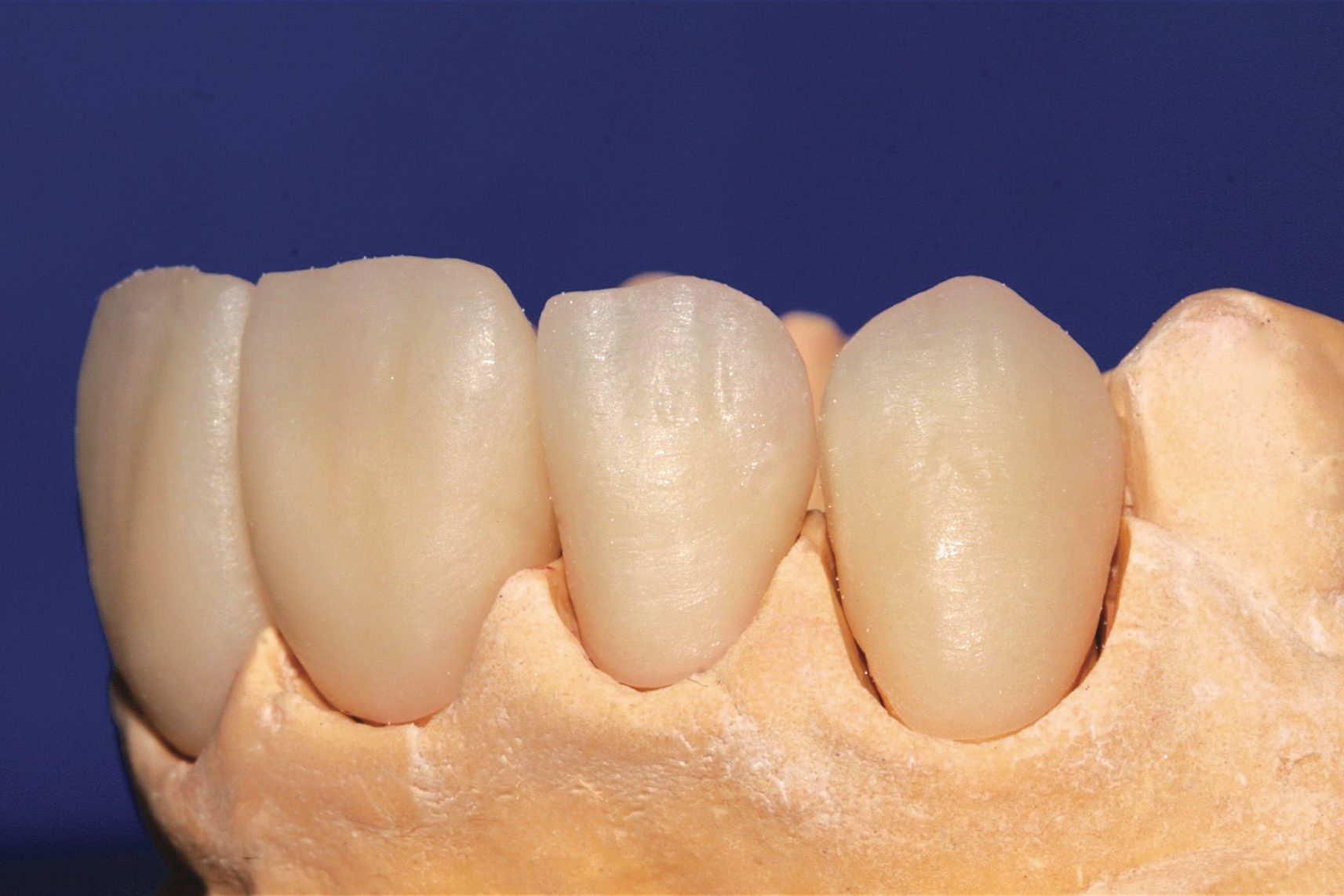 strigl 28