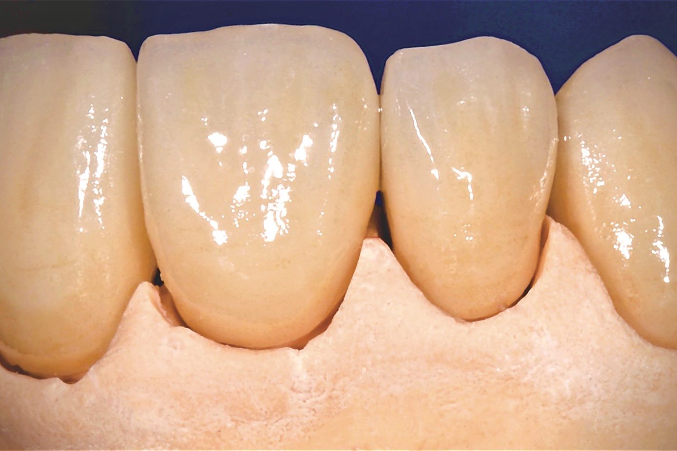 strigl 30