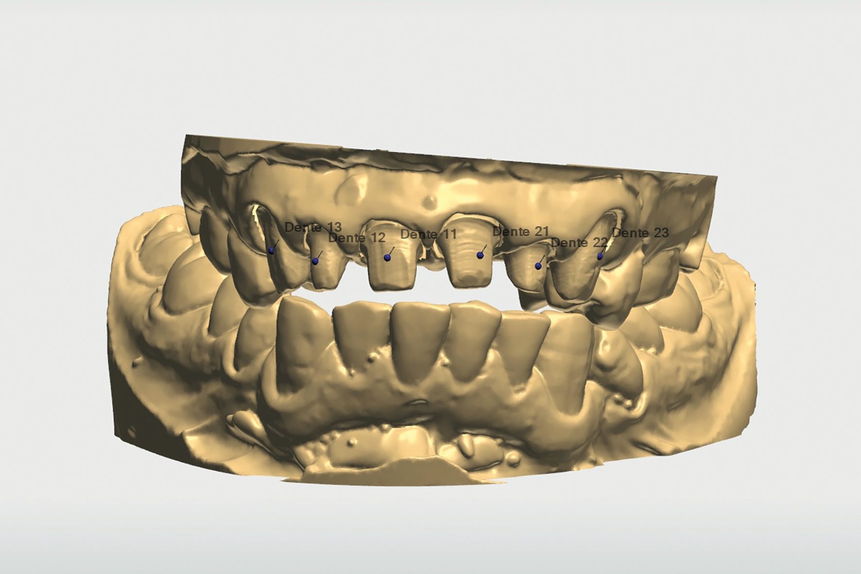 strigl 5
