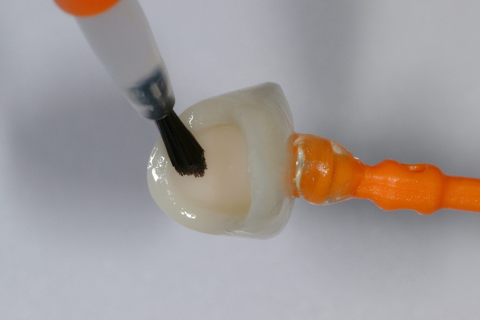 Ceramic Crown_017