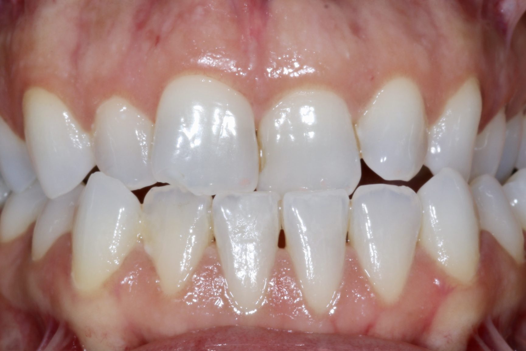 Fig 3