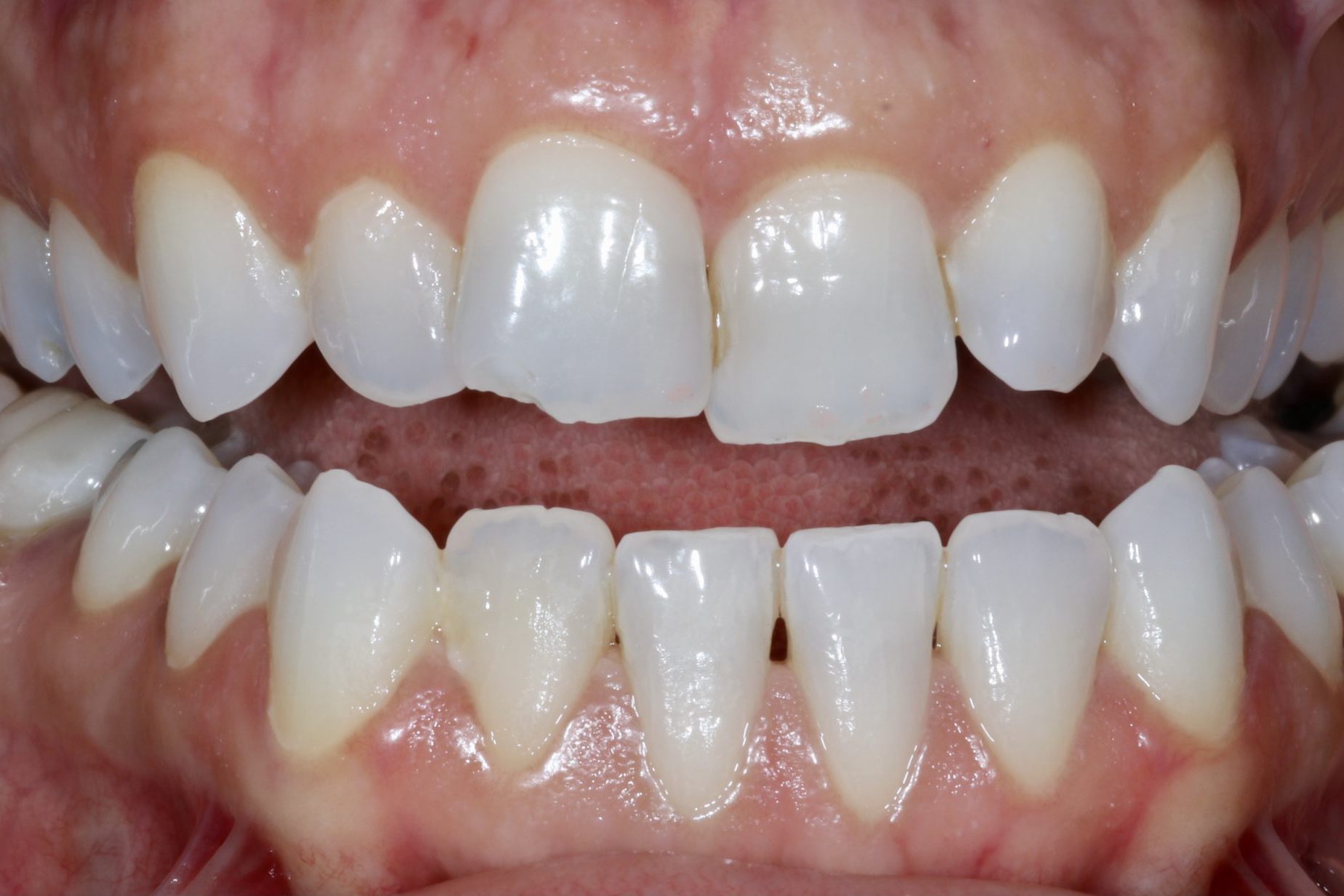 Fig 6