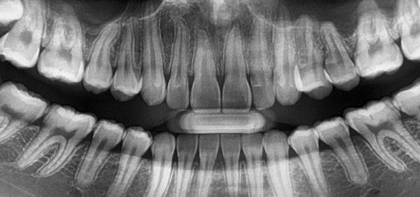 Dentistry's guide to digital dental X-ray machines