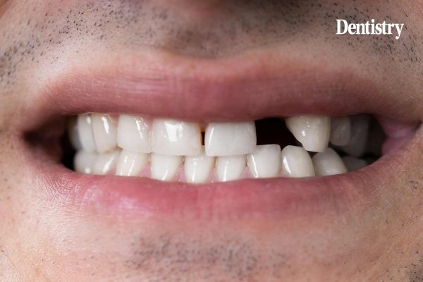 Scientists have successfully created the environment needed for lab-grown teeth, marking a major breakthrough in their research.