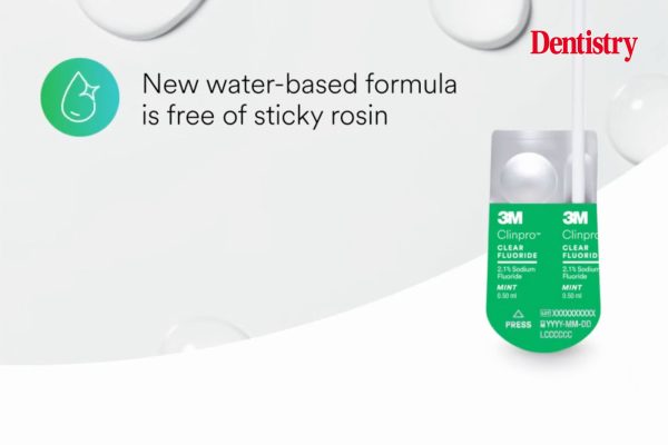 fluoride treatment
