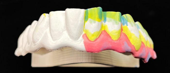 Freudenthal case2a