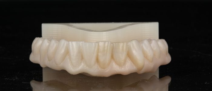 Freudenthal case2b