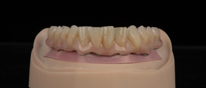 Freudenthal case2c