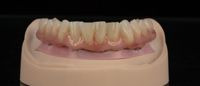 Freudenthal case2d