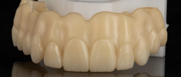 Freudenthal case3a