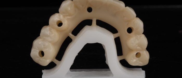 Freudenthal case3b