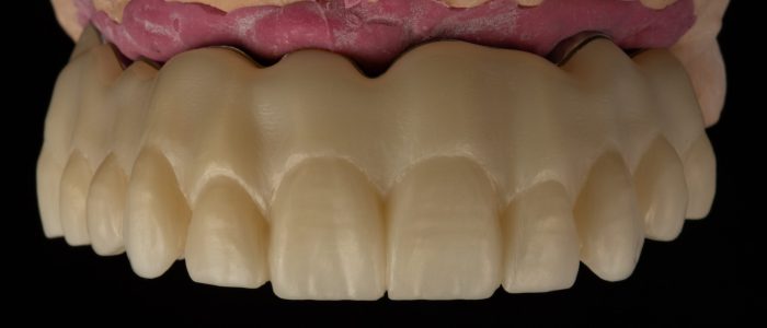 Freudenthal case3c
