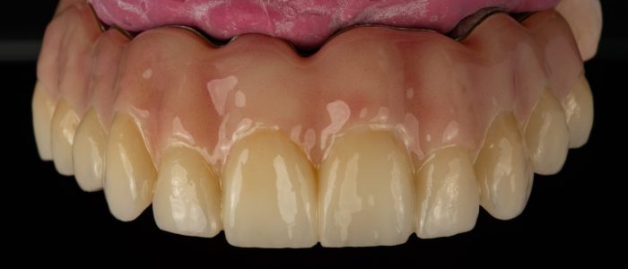 Freudenthal case3d